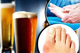 有痛风，还能喝酒吗？痛风患者如何降尿酸呢？医生一文给您说清楚图片