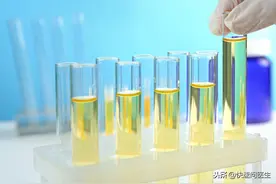 早上起床第一泡尿，如果有3个特征，恭喜你很健康图片