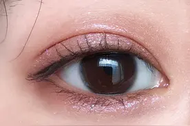 双眼皮术后恢复时间为什么有长有短图片