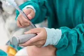 小孩将笔帽吸进气管，抬手术室已来不及，医生一下给拽了出来，救了条命图片