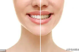 牙齿矫正，到底有没有风险？做牙齿矫正之前一定要了解图片