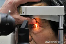 飞蚊症会变成白内障吗？该如何治疗？图片