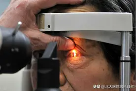 飞蚊症会变成白内障吗？该如何治疗？图片
