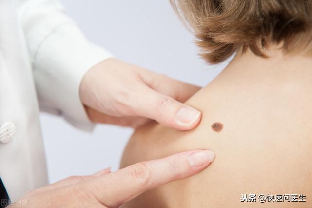 大腿上起了很多小红点不疼不痒怎么回事（身上出现很多小红点）