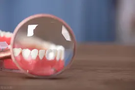 满嘴都是牙结石，还在用手抠？正确处理牙结石，别光靠洗牙图片