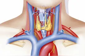 甲状旁腺切除后……图片