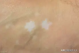 小白点出现？请警惕图片