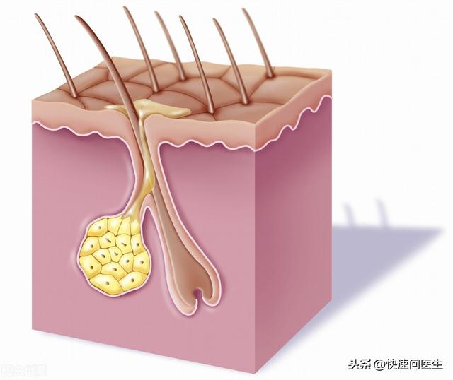 手臂上的小红点是什么？可能是以下3个原因，看下你有没有