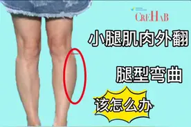 小腿肌肉外翻整个腿型都很弯曲，很有可能和你忽略的“它”有关图片