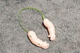 男子给鸡装上了假“手臂”，画风走向越发奇怪，鸡：求你做个人图片