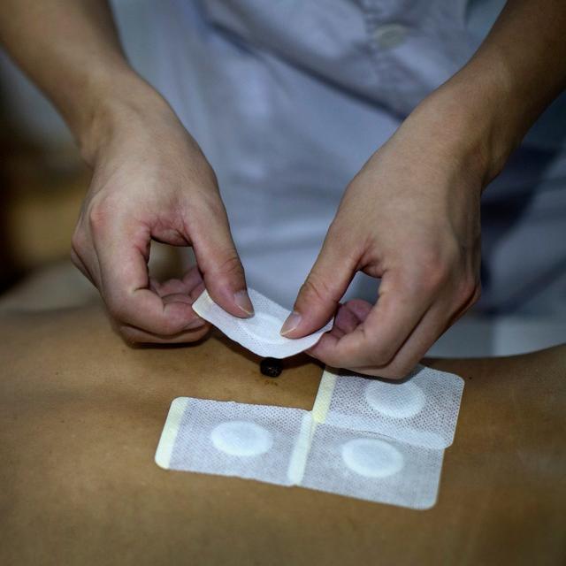 中医外治方法,穴位贴敷的秘密,揭开她前世今生的面纱.