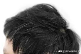 吃什么可以黑发，补肾，抗衰老抗疲劳，养生？中医推荐黄精图片
