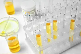 加快尿酸排泄，预防复发，这4种食物很适合痛风患者！知道就赚到图片