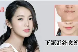 面部「脸歪不正、大小脸」，这两个问题你中枪了吗？图片