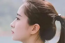 植发3个月，现在头发恢复成这样了图片