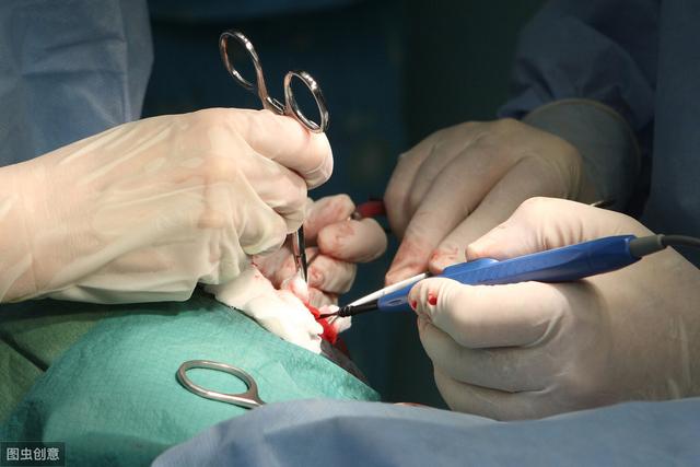 斜视手术需要做2到3次?(治斜视多少钱啊) - 冷求网