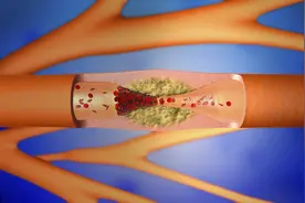 有什么茶能“通血管”？医生辟谣：养护血管健康，要讲科学图片