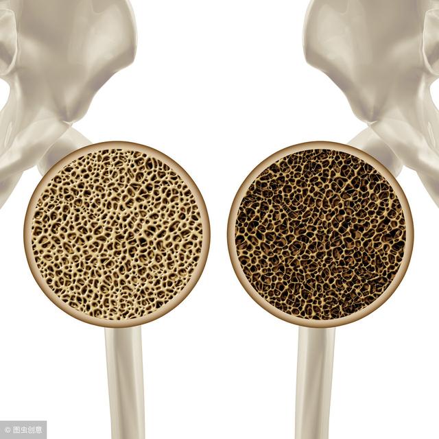 防骨松只补钙？骨科医生：这3种营养素，保骨强骨，骨头硬如石！