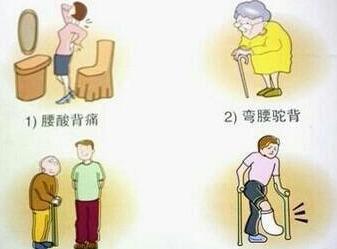 如何预防和治疗骨质疏松症