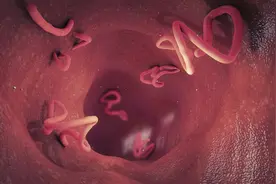 身体出现这六种情况要注意，可能寄生虫已经“遍布全身”图片