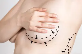 隆胸术后5年患乳腺癌！隆胸到底安不安全？专家这样说！图片