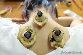 艾灸既治也致癌？这不是危言耸听图片