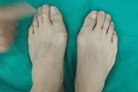 为什么大脚骨都是女性？你知道原因吗？听我来解密图片