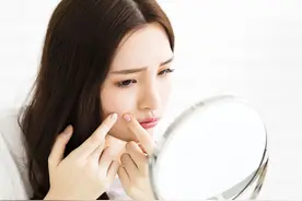 化妆品会不会“闷痘”？皮肤科医生破解“闷痘”的真相图片