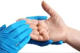 手脚经常脱皮，是因为缺乏维生素吗？看看专家怎么说图片