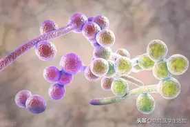 摆脱不掉的湿疹、头皮屑可能是真菌感染，不能忽视图片