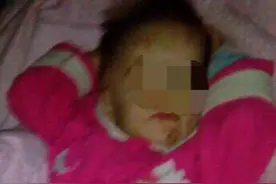 牙齿掉落，耻骨骨折…俄2岁女童遭生母虐待，竟因长得像父亲图片