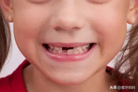 宝宝掉牙了？最全的宝宝换牙攻略！收藏备用图片
