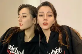 脸上这4个部位长痣，没准会很惊艳，并不一定是越白净越好看图片