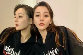 脸上这4个部位长痣，没准会很惊艳，并不一定是越白净越好看图片