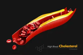 PCSK9靶向血脂调节药是“鸡肋”吗？图片