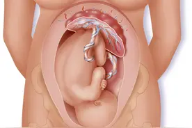 女性的孕子之处 女子胞图片