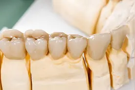 戴上牙冠之后牙齿疼痛酸软，到底是因为什么？牙医告诉你怎么解决图片