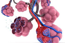 肺里长了肺大泡，会发展成肺癌么？图片