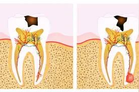 牙齿不好会影响寿命吗？答案是肯定的图片