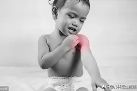 孩子皮肤痒痒痒，湿疹反复发作，怎么办？儿科医生3招搞定！图片
