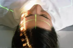 全脑放疗常见问题图片