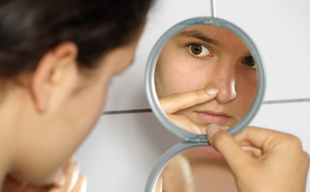 非角化型细胞额