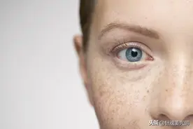 36岁满脸黄褐斑，老中医一个活血祛斑方，让女人面若桃花图片