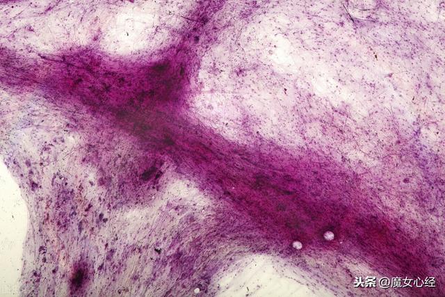 鐨偆鍚告敹鎶よ偆鍝佽惀鍏伙紝涓嶅彧鏄粏鑳炲惛鏀舵墠鏈夌敤