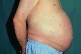 半边莲，历代治疗蛇伤之要药，消腹中水，退四肢肿图片