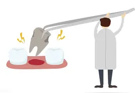 拔牙后这些问题要注意图片