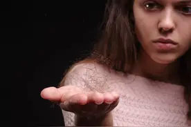 11岁小学女孩前额“秃”了：头皮不疼头发没了！“少年秃”竟可能是这种精神疾病图片