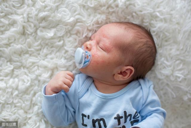 8岁女孩脸部有毛囊角化丘疹