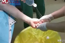 真剁手！与家人吵架急眼，男子砍下自己的手指图片