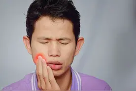 一吃辣舌头就痛！他以为生口腔溃疡，却一度生命垂危图片